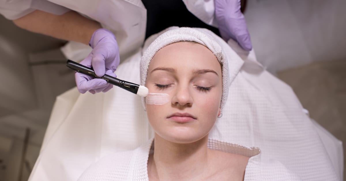 Benefits & Types of Chemical Peels