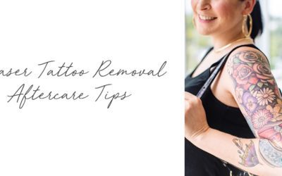 Laser Tattoo Removal Aftercare Tips