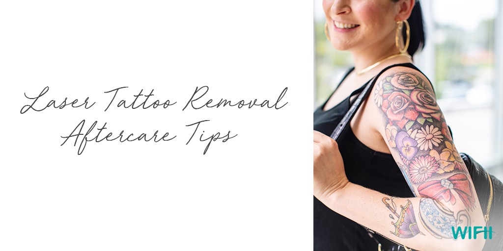 Laser Tattoo Removal Aftercare Tips