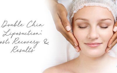 Double Chin Liposuction: Cost, Recovery & Results
