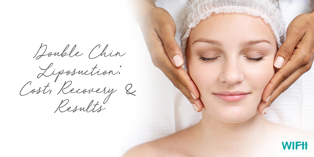 Double Chin Liposuction: Cost, Recovery & Results