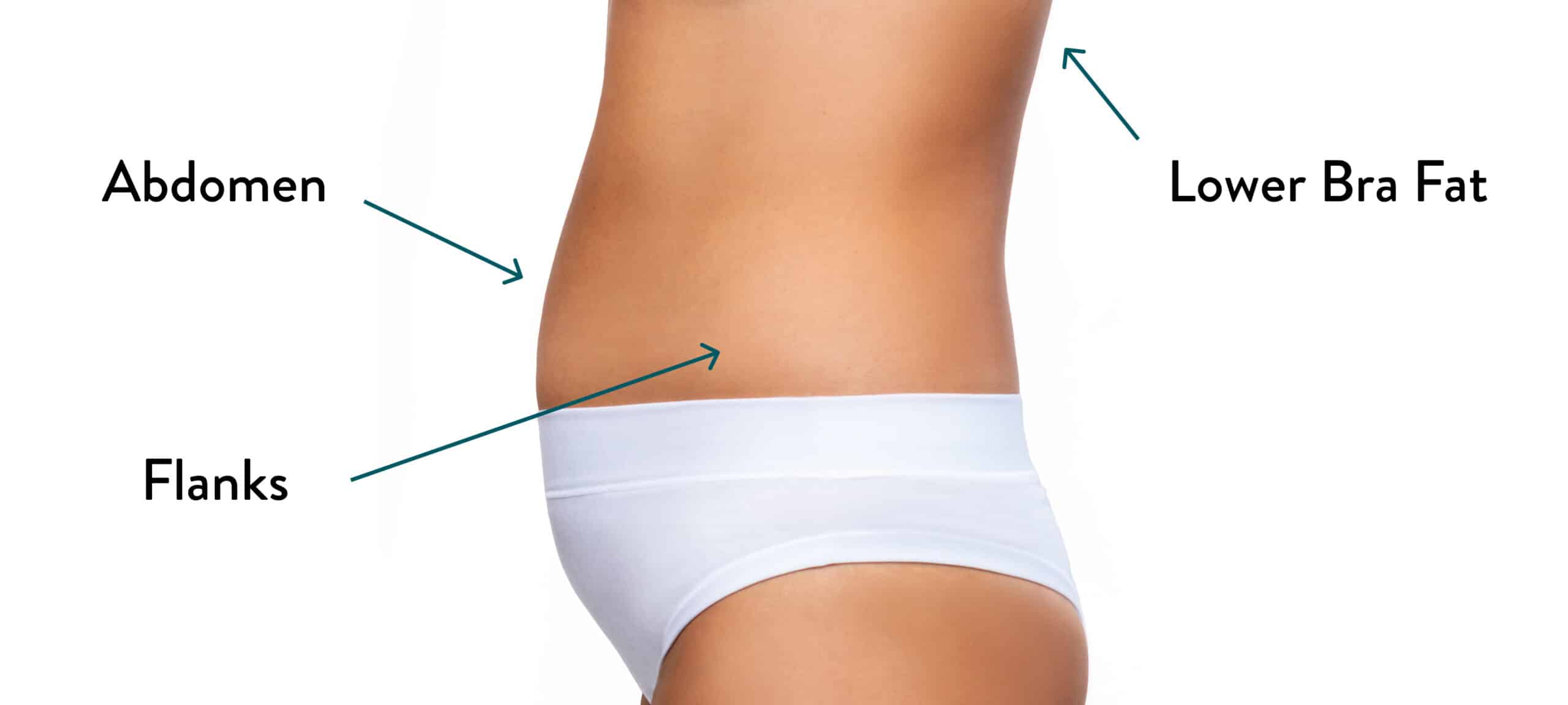 360 Liposuction Areas Treated