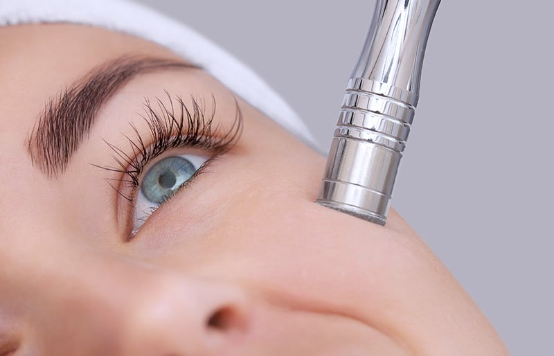 Woman getting a Microdermabrasion treatment - What Happens During a Microdermabrasion Treatment?
