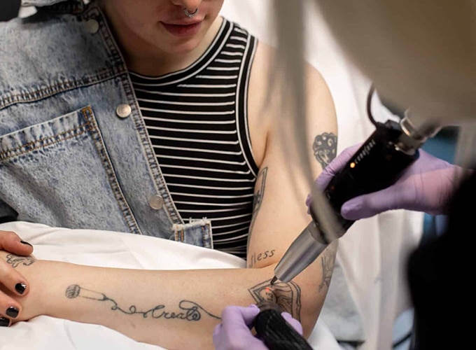 What Are The Risks/Side Effects Of Laser Tattoo Removal