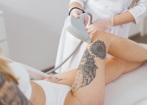 Can You Get Laser Hair Removal Over a Tattoo