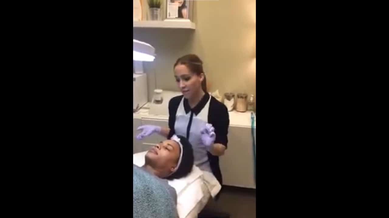 Microneedling Treatment - Demonstration and Q&A