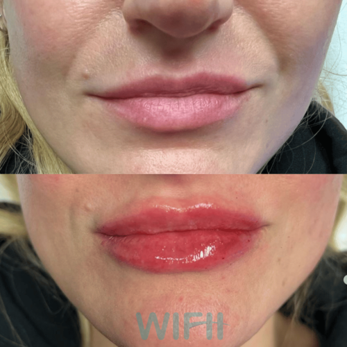 WIFH Filler 1