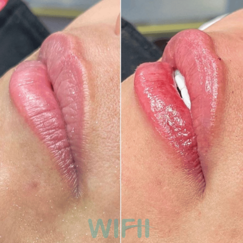 WIFH Filler 2