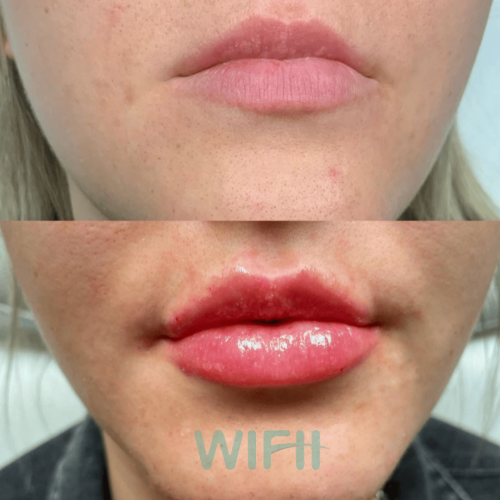 WIFH Filler 4